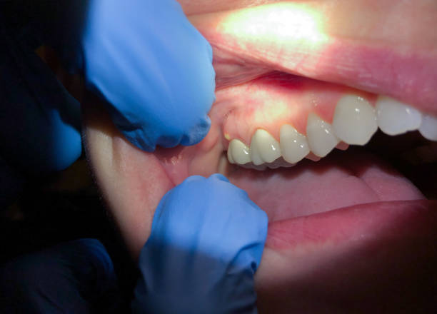 Best Emergency Tooth Extraction  in Petersburg, VA